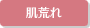 肌荒れ